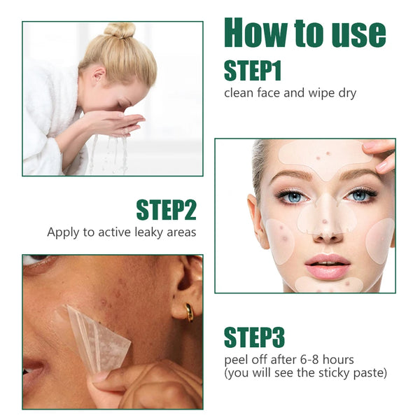 10pcs Full Face Pimple Patches Acne Removal Pimple Extraction Mask Protect Skin Face Cleaning for Nose Chin Forehead for Cheek